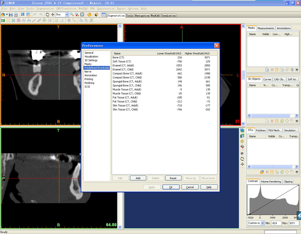 MIMICS,MagisRP,Simplant,Materialise,3-matics